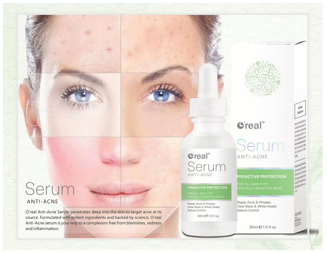 Serum Anti Acne